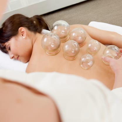 Schröpfmassage am Rücken mit mehreren Glasschröpfköpfen